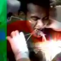 Un malayo va a pescar y termina en urgencias con un pez vivo atascado en la boca