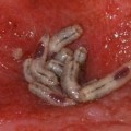 Historia médica de la terapia larval: Gusanos que curan