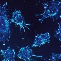 Científicos logran que células que causan cáncer mueran de hambre