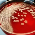 Descubren el compuesto que mata al 98% de bacterias resistentes a los antibióticos