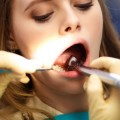 Llega la alternativa a la endodoncia: regenerar dientes