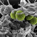 ¿Por qué las bacterias se hacen resistentes a los antibióticos?