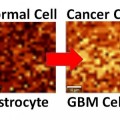 Primer uso del grafeno para detectar células cancerosas