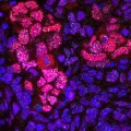 Signos de rejuvenecimiento celular en la reprogramación ‘in vivo’