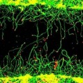 Sustancia capaz de reparar axones dañados de neuronas