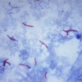 Investigadores encuentran una forma de revertir la resistencia a los antibióticos de la Mycobacterium tuberculosis [eng]