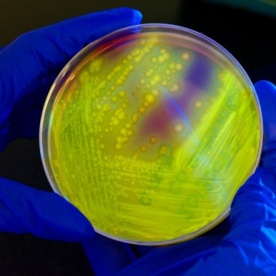 Una pastilla de CRISPR para sustituir los antibióticos
