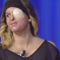 La miss italiana que fue atacada con ácido por su exnovio muestra su rostro desfigurado en TV