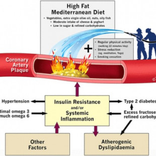 La grasa saturada no tapa las arterias: la enfermedad coronaria es una condición de inflamación crónica [EN]
