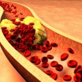 Si no es la grasa saturada ¿qué es lo que obstruye las arterias?