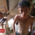 BBC Mundo: las impactantes imágenes que muestran el drama de la severa desnutrición infantil en Venezuela