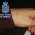 Seis detenidos por marcar una esvástica a una chica con un objeto candente