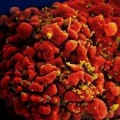 Un fármaco logra desalojar el VIH de los reservorios para eliminar la infección