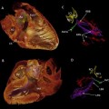 Revelan la fuente de los latidos del corazón humano en 3D (ING)
