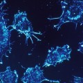 La técnica contra el cáncer que podría desbancar a la quimioterapia y la radioterapia