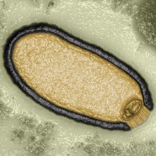 Evidencias sobre la aparición de la vida en la tierra encontradas en un virus gigante [ENG]