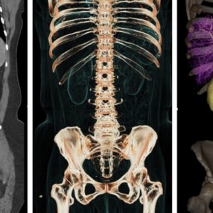Nvidia quiere revolucionar los escaneos médicos gracias a su nueva IA de reconocimiento de órganos por un dólar
