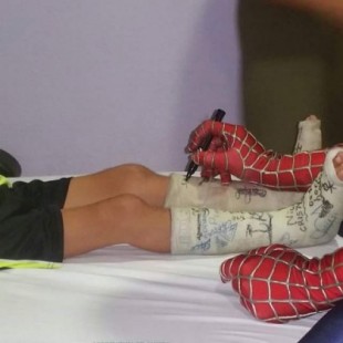 El hospital Puerta del Mar prohíbe la entrada al 'Spiderman' que visitaba a niños enfermos