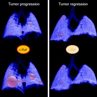 Una terapia genética induce la regresión de tumores de pulmón en ratones