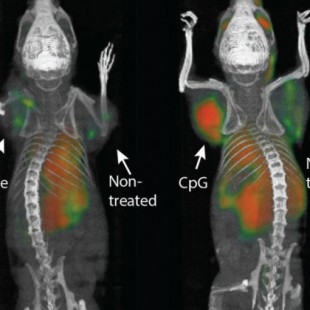 Una novedosa terapia elimina todo resto de cáncer en ratones