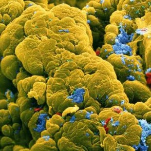 Dos cepas de bacterias son las causantes del cancer de colon según estudio