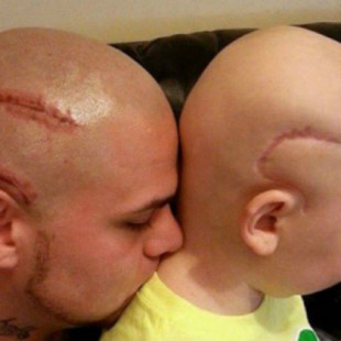 La despedida del padre que se tatuó una cicatriz como la de su hijo en la cabeza