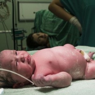 La OMS advierte de intervenciones innecesarias en el parto