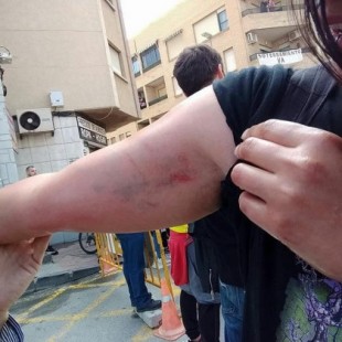 La Policía carga contra un grupo de mujeres que protestaban contra el muro de Murcia