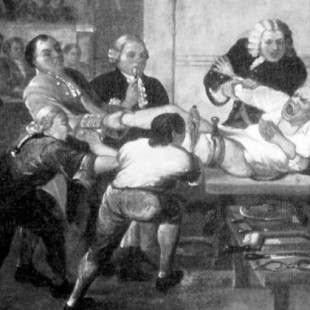 Sangre, guarrería y gritos bárbaros: así era la cirugía en la era victoriana