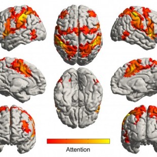 La música activa regiones del cerebro preservadas por la enfermedad de Alzheimer (ENG)