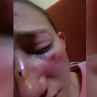 Una joven, agredida en A Coruña por dos menores tras negarse a darles su número de teléfono