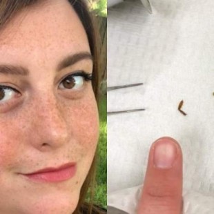 Una joven de Florida soporta nueve días con una cucaracha dentro del oído