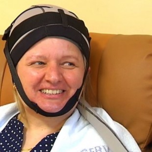 Comienzan a implantarse los cascos que evitan la pérdida de pelo durante la quimioterapia