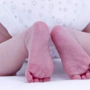 Amputan la pierna a un bebé recién nacido después de que una enfermera se la quemase con un secador