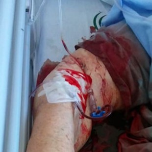 Dejan sangrando a una mujer de 89 años durante más de tres horas en el Virgen Macarena