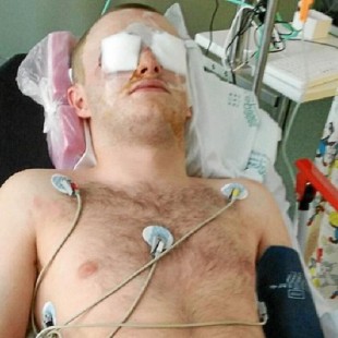 Un turista acaba con los ojos destrozados durante una fiesta en Magaluf