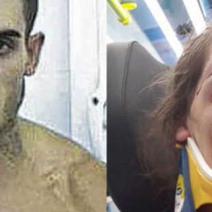 La brutal paliza que el boxeador Arnau propinó a su novia de Mallorca: "Casi me mata"