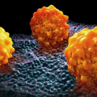 La nanotecnología puede curar la metástasis del cáncer de colon