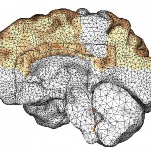 Nueva simulación muestra cómo la enfermedad de Alzheimer se propaga a través del cerebro (ING)