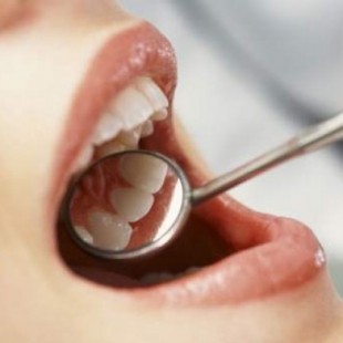 Indemnización récord: 2,5 millones a una alérgica al metal a quien la dentista puso una prótesis de cobalto