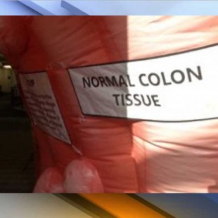 Roban en Kansas un colon inflable valorado en 4.000 dólares [ENG]