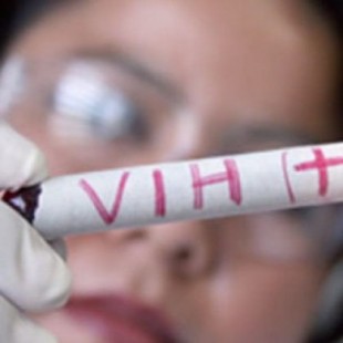 Un estudio francés abre una puerta para acabar con el VIH