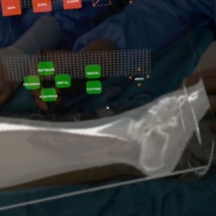 Tecnología pionera del Hospital Gregorio Marañón; realidad aumentada y 3D sobre el paciente en quirófano