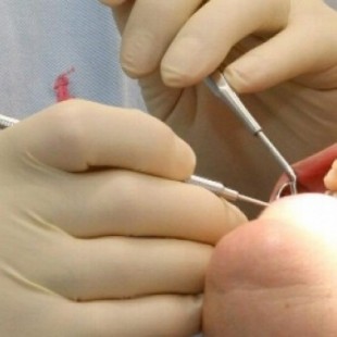 Iniciativa en Barcelona: dentistas municipales con descuentos de hasta el 40%