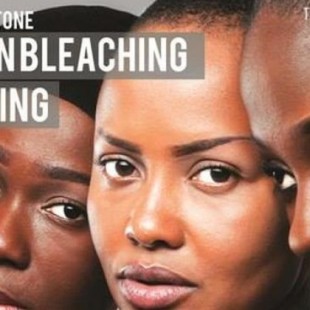 Ruanda declara la guerra a los productos que blanquean la piel