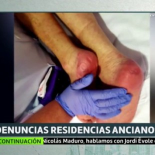 Heridos, desnutridos y cubiertos de orina: los maltratos a ancianos en una residencia de Madrid