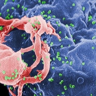 El "paciente de Düsseldorf": una tercera persona también puede estar en remisión del VIH  [ ing ]