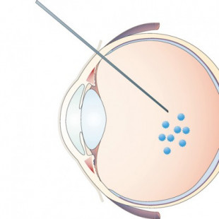 Ratones ciegos recuperan la vista con la simple inserción de un gen (ING)