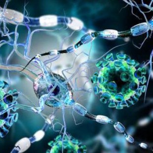 Terapia celular restaura sistema inmune pacientes con esclerosis múltiple 