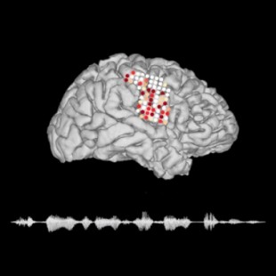 Un dispositivo para traducir la actividad cerebral en lenguaje hablado
